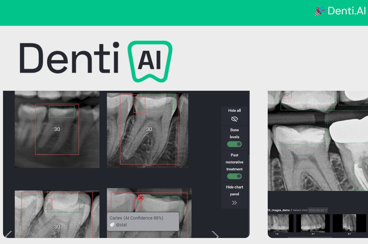 Denti AI