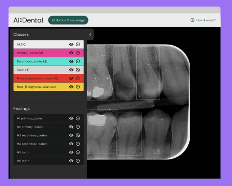 AI:D for dentists 