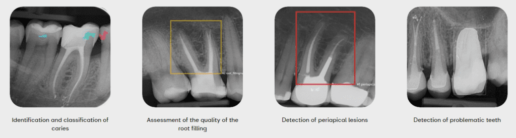 AIDental Accelerated Diagnostics